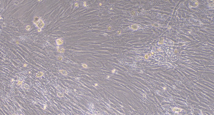 Primary Mouse Thymic Fibroblasts (TF)