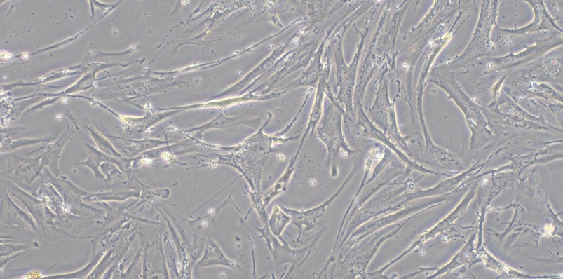 Primary Human Hepatic Stellate Cells (HSC)