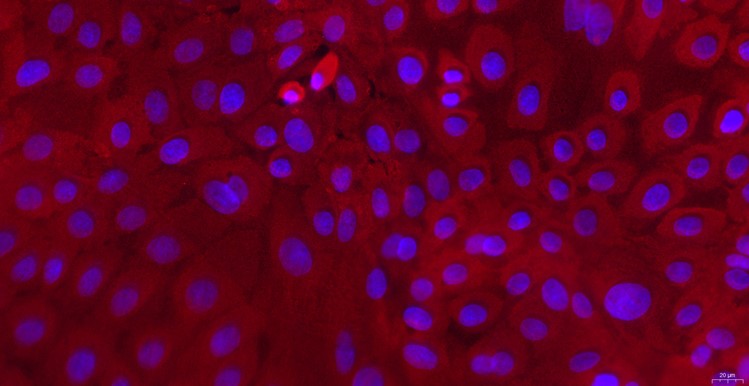 Primary Rabbit Gingival Epithelial Cells (GiEC)