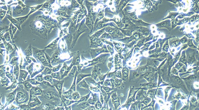 Human Lung Adenocarcinoma Cells (LA)