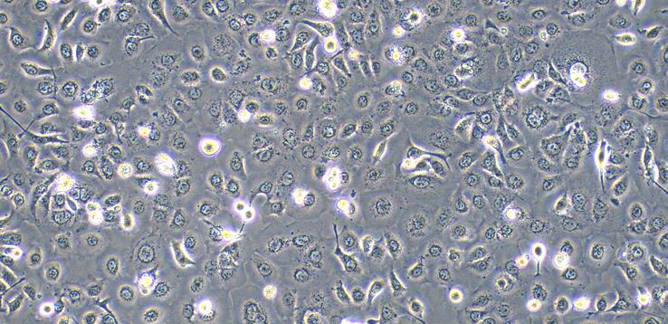 Human TE-1 Esophageal Carcinoma Cells (TE-1)