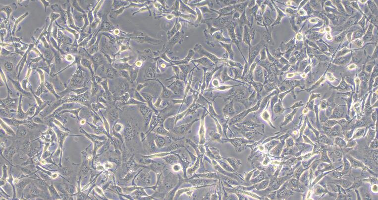 Human Fibrosarcoma Cells (FSC)