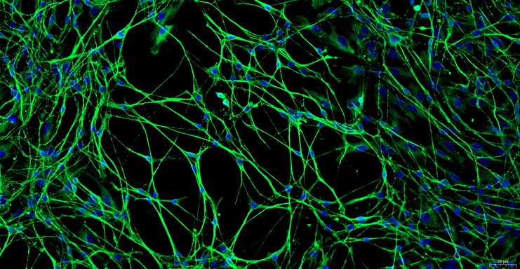 Primary Mouse Dorsal Root Ganglion Neuron Cells (DRGN)