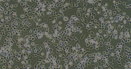 Human <b>A278</b>0 Ovarian Carcinoma Cells (<b>A278</b>0)