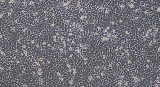 Human E<b>C970</b>6 Esophageal Carcinoma Cells (E<b>C970</b>6)