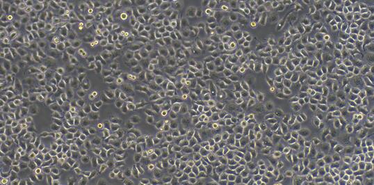 Human SG<b>C790</b>1 Gastric Cancer Cells (SG<b>C790</b>1)