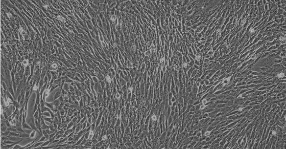 Rat A7r5 Aortic Vascular Smooth Muscle Cells (A7r5)