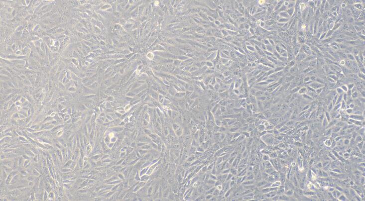 Simian Vero African Green Monkey Kidney Cells (Vero)