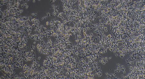 Human <b>C666</b>-1 Nasopharyngeal Carcinoma Cells (<b>C666</b>-1)