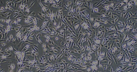 Human MDA-MB-231 Triple-negative Breast Cancer Cells (MDA-MB-231)