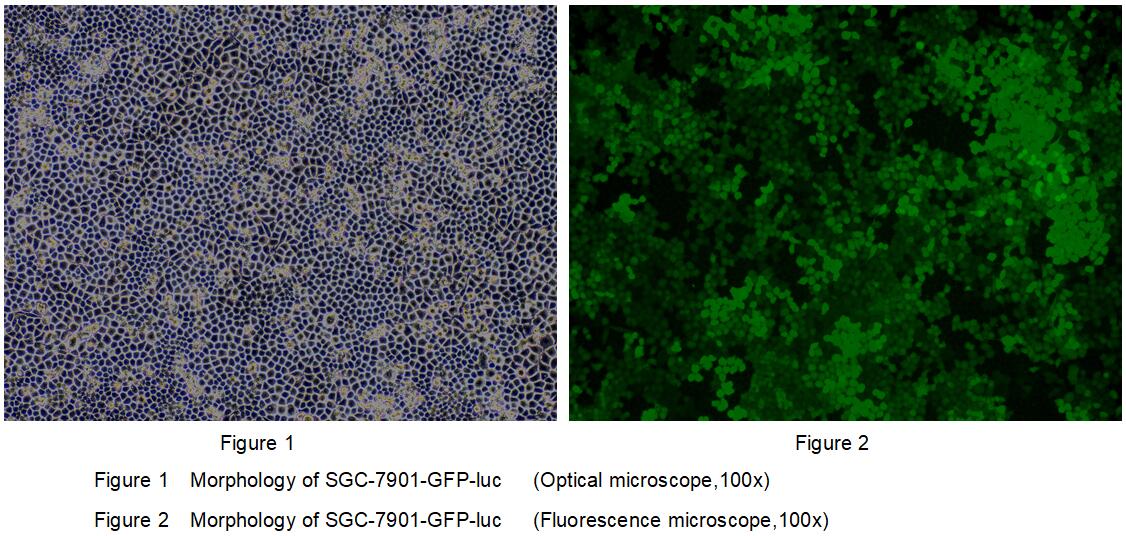 Human Luciferase SG<b>C790</b>1 Gastric Cancer Cells (SG<b>C790</b>1-Luc)