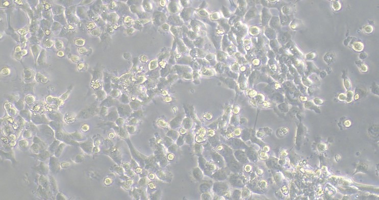 Human Fadu Pharyngeal Squamous Carcinoma Cells (Fadu)