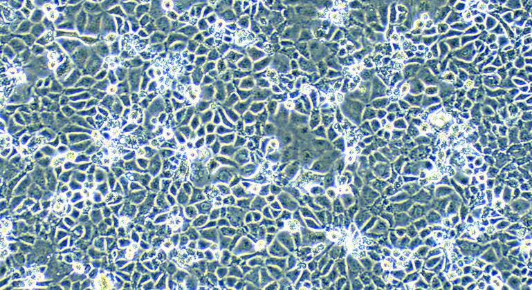 Human PLC/PRF/5 Hepatocellular Carcinoma Alexander Cells (PLC/PRF/5)