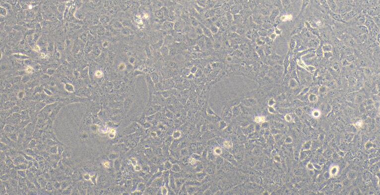 Human Nthy-ori 3-1 Thyroid Normal Cells (Nthy-ori 3-1)