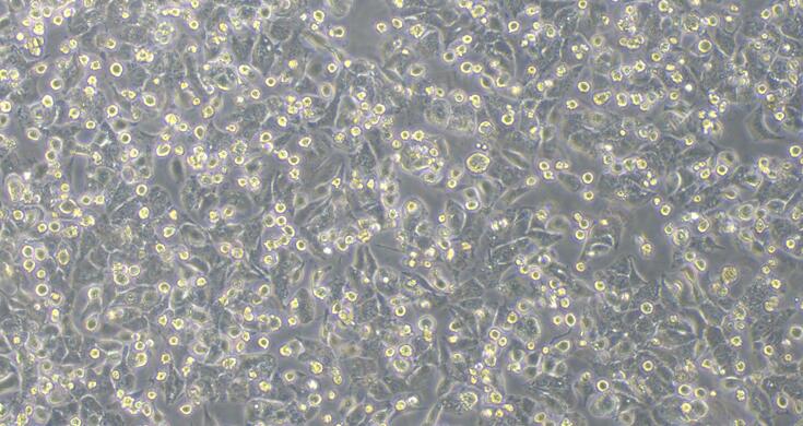 Human MHCC97-H Hepatocellular Carcinoma Cells (MHCC97-H)