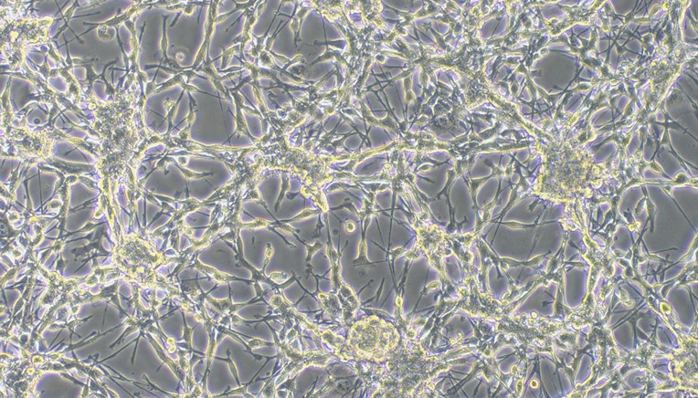 Mouse CT26.WT Colon Carcinoma Cells (CT26.WT)