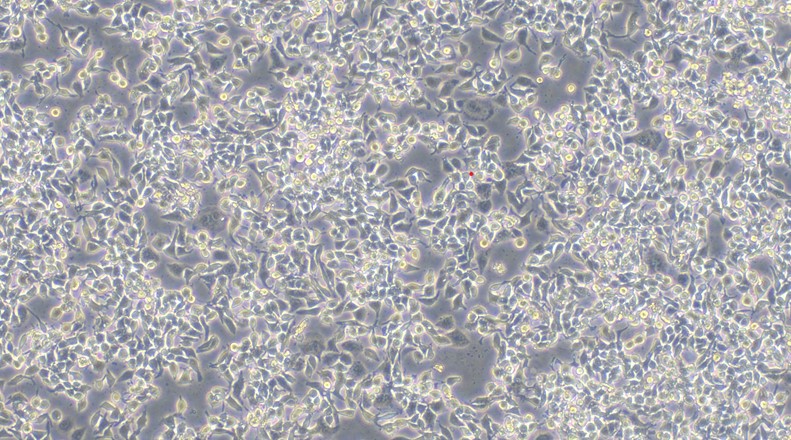 Human HCe-8693 Cecal Adenocarcinoma Cells (HCe-8693)