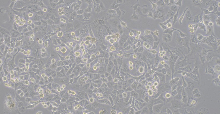 Human DLD-1 Colorectal Adenocarcinoma Epithelial cells (DLD-1 )