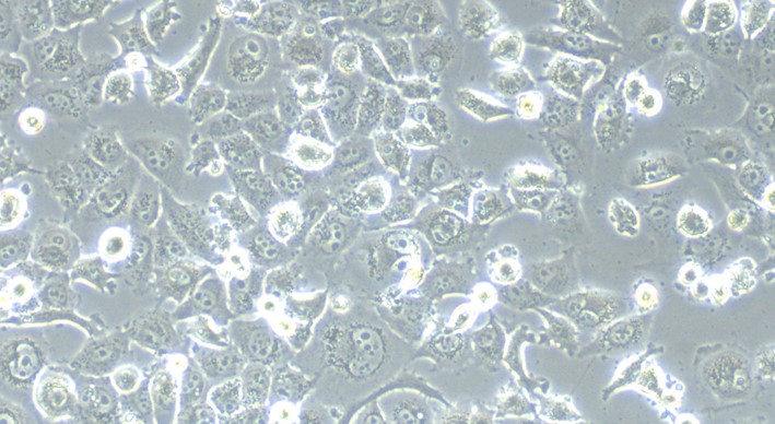 Human NCI-H1299 Non-Small Cell Lung Cancer Cells (NCI-H1299)