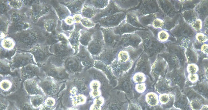 Human NCI-H2030 Non-Small Cell Lung Cancer Cells ( NCI-H2030 )