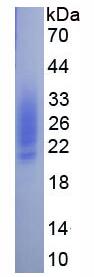 Eukaryotic Colony Stimulating Factor 2, Granulocyte Macrophage (GM-CSF)