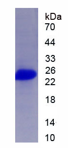 Eukaryotic Interferon Gamma (IFNg)