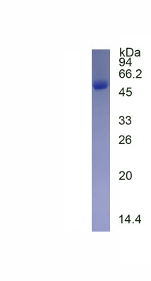 Eukaryotic Insulin Like Growth Factor 1 (IGF1)