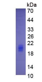 Eukaryotic Interleukin 5 (IL5)