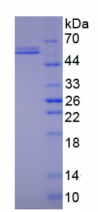 Eukaryotic Matrix Metalloproteinase 1 (MMP1)