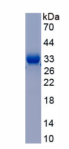 Eukaryotic Superoxide Dismutase 3, Extracellular (SOD3)