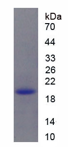 Eukaryotic Vascular Endothelial Growth Factor C (VEGFC)