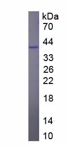 Eukaryotic Triggering Receptor Expressed On Myeloid Cells 1 (TREM1)