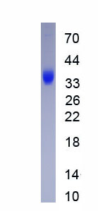 Eukaryotic Alpha-1-Microglobulin (a1M)