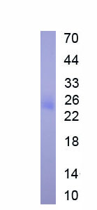 Eukaryotic Procollagen II N-Terminal Propeptide (PIINP)