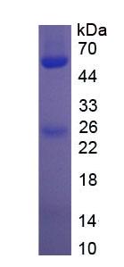 Eukaryotic Immunoglobulin G (IgG)