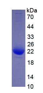 Eukaryotic Interleukin 1 Beta (IL1b)