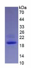 Eukaryotic Interleukin 1 Beta (IL1b)