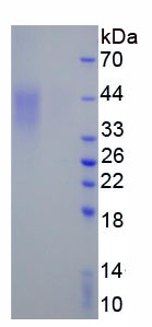 Eukaryotic Programmed Cell Death Protein 1 (PD1)