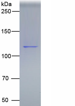 Eukaryotic Epidermal Growth Factor Receptor (EGFR)