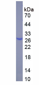 Eukaryotic C Reactive Protein (CRP)