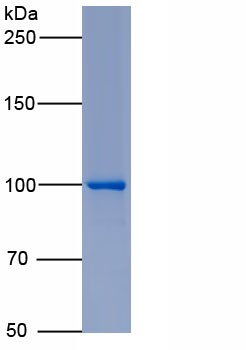 Eukaryotic Glycogen Phosphorylase, Muscle (PYGM)