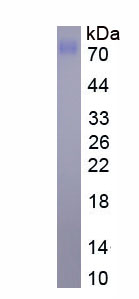 Eukaryotic Alkaline Phosphatase, Tissue-nonspecific (ALPL)