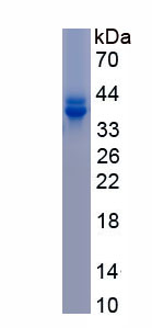 Eukaryotic Metallothionein 1 (MT1)