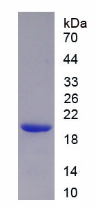 Eukaryotic Cytokeratin 19 (CK19)