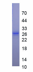 Eukaryotic Neutrophil gelatinase-associated lipocalin (NGAL)