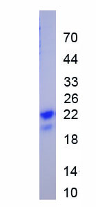 Eukaryotic Vascular Endothelial Growth Factor 165 (VEGF165)