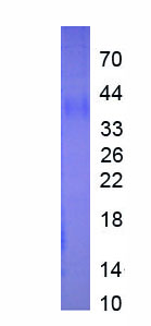 Eukaryotic Interleukin 34 (IL34)