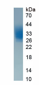 Eukaryotic Interleukin 22 (IL22)