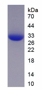 Eukaryotic Lysyl Oxidase (LOX)