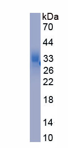 Eukaryotic Sclerostin (SOST)